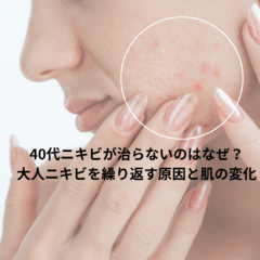 40代ニキビが治らないのはなぜ？大人ニキビを繰り返す原因と肌の変化