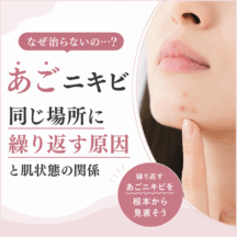 あごニキビが治らないのはなぜ？同じ場所に繰り返す原因と肌状態の関係