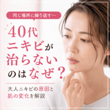 40代ニキビが治らないのはなぜ？大人ニキビを繰り返す原因と肌の変化