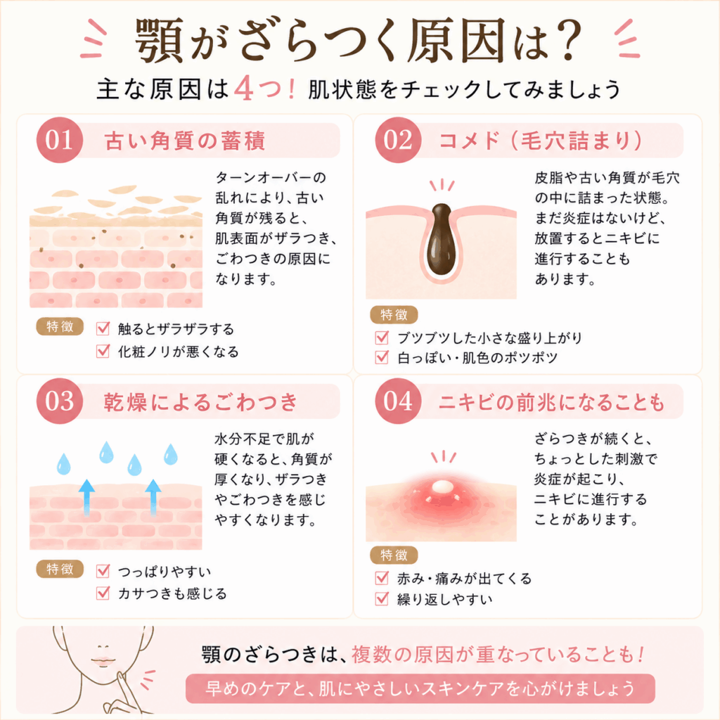 顎がざらつく主な原因を解説した図解画像。古い角質の蓄積、コメド（毛穴詰まり）、乾燥によるごわつき、ニキビの前兆との関係を紹介