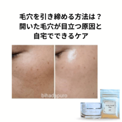 毛穴を引き締める方法は？開いた毛穴が目立つ原因と自宅でできるケア