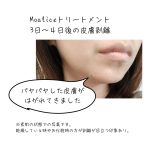 シリカニードル　剥離